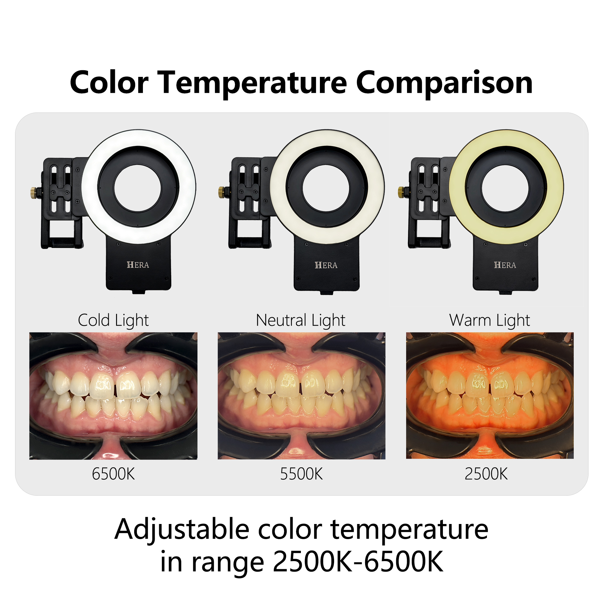 HERA MK-23 Intraoral Dental Ph - Photography Lighting Ring のレビューと価格