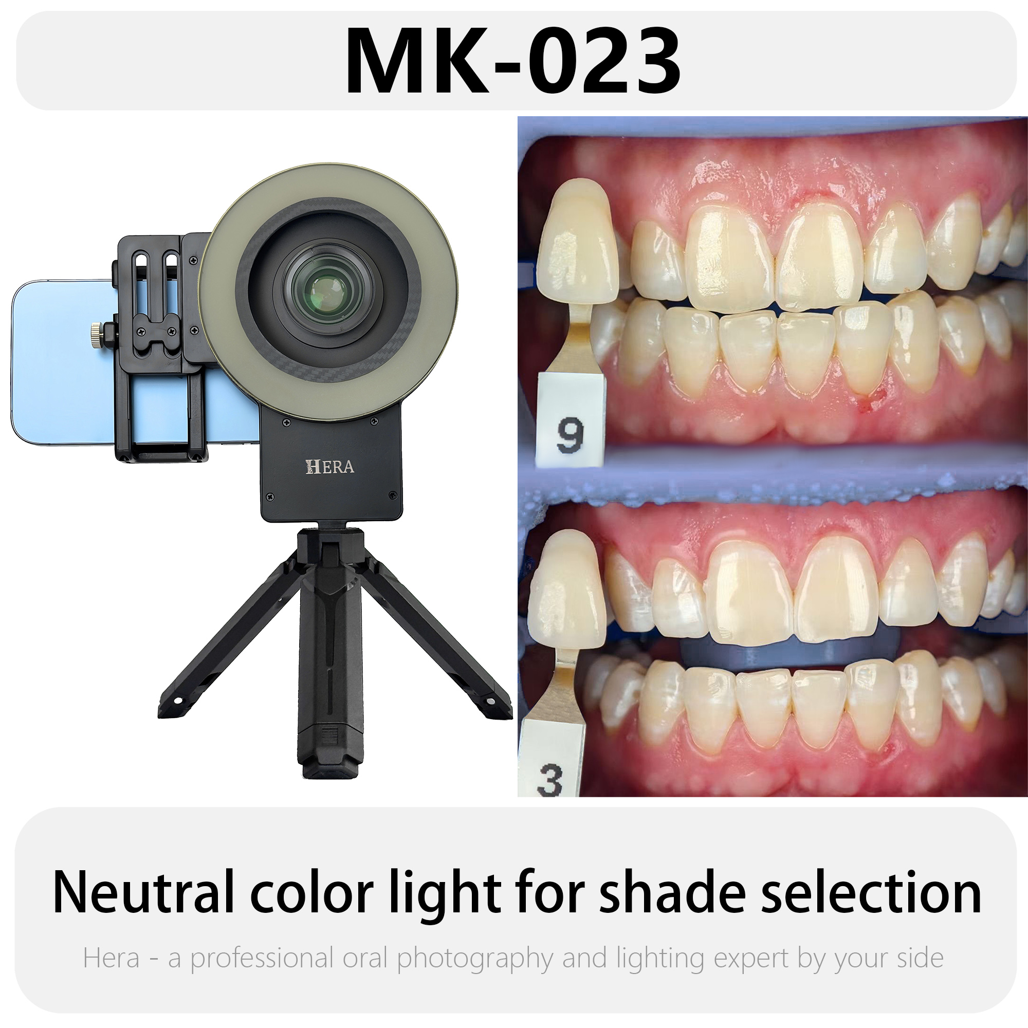 HERA MK-23 Intraoral Dental Ph - Photography Lighting Ring のレビューと価格