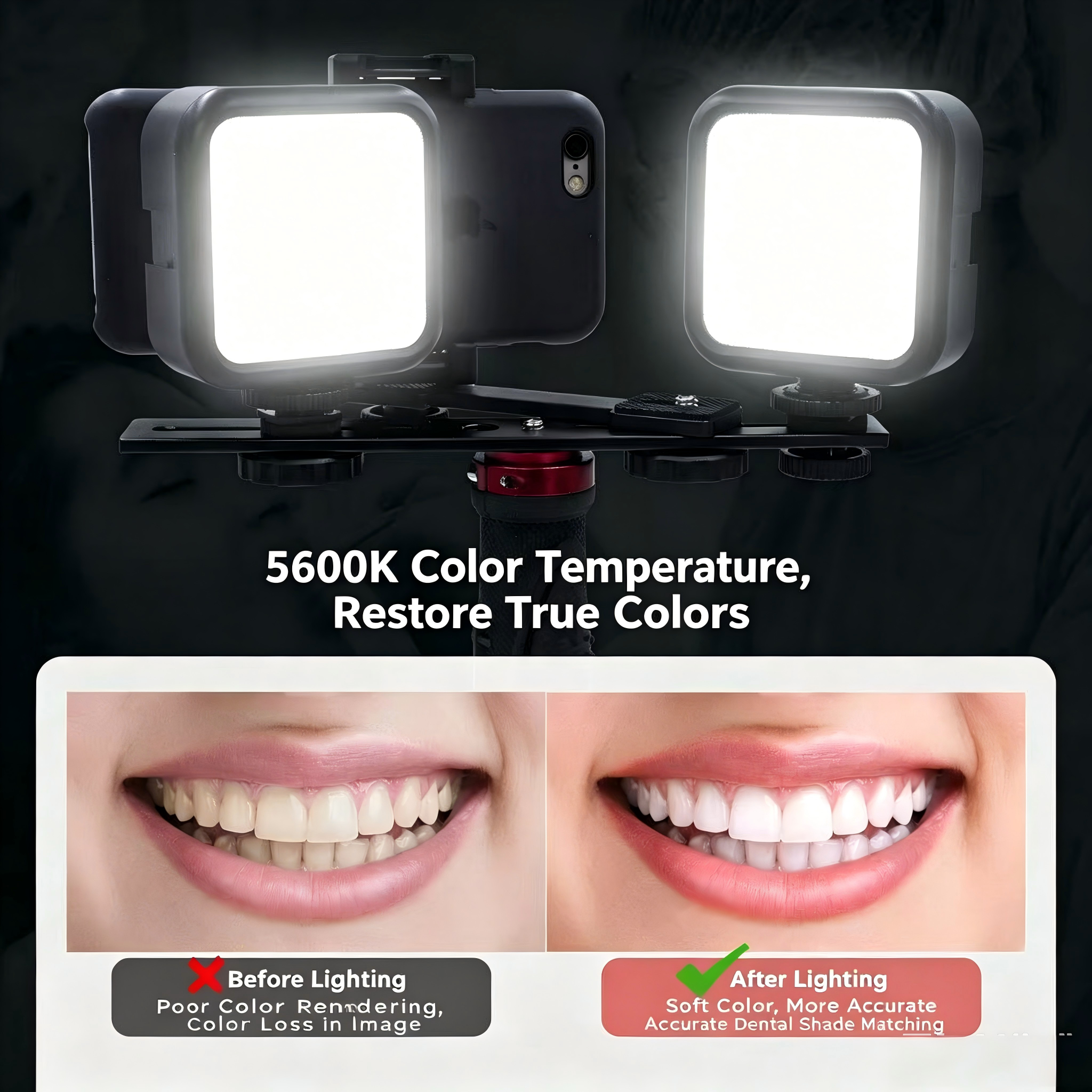 Portable Dental Photography Li - Photography Lighting Basics のレビューと価格